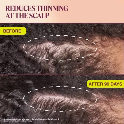 Roots of Fullness Pack – Complete Hair Densifying Set | The Rootist by Amare