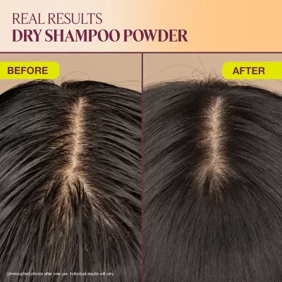 Roots of Transformation Pack – Complete Fermented Hair Care Collection by The Rootist™