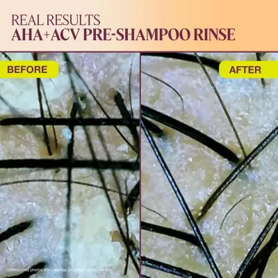 Roots of Transformation Pack – Complete Fermented Hair Care Collection by The Rootist™